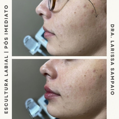 Escultura Labial